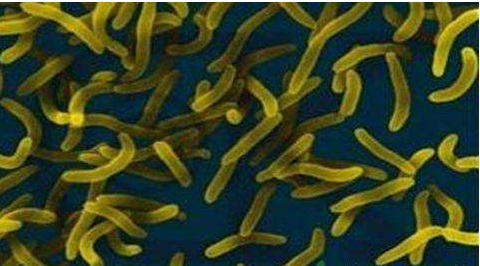 微生物菌劑好？好在哪里您知道嗎？